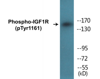 Western blot analysis of extracts from 293 cells treated with Insulin, using IGF1R (Phospho-Tyr1161) Antibody.