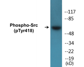 Western blot analysis of extracts from COLO205 cells treated with serum 15% 10', using Src (Phospho-Tyr418) Antibody.