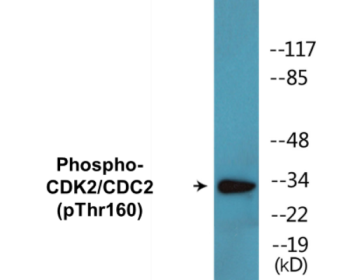 Western blot analysis of extracts from A2780 cells, using CDK2 (Phospho-Thr160) Antibody.