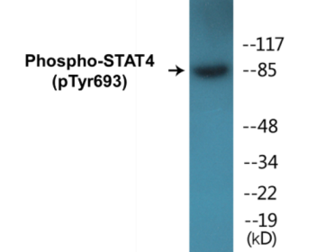 Western blot analysis of extracts from HeLa cells treated with IL-4, using STAT4 (Phospho-Tyr693) Antibody.