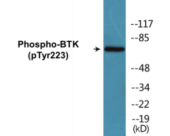 Western blot analysis of extracts from HeLa cells treated with Serum 10% 15', using BTK (Phospho-Tyr223) Antibody.