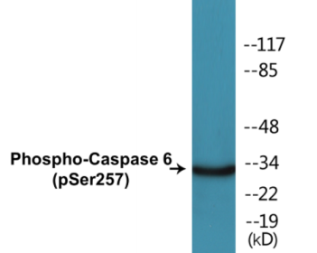 Western blot analysis of extracts from 293 cells treated with Etoposide 25uM 60', using Caspase 6 (Phospho-Ser257) Antibody.