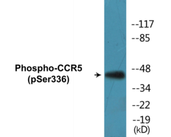 Western blot analysis of extracts from Jurkat cells, using CCR5 (Phospho-Ser336) Antibody.