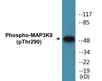 Western blot analysis of extracts from 293 cells treated with UV 15', using COT (Phospho-Thr290) Antibody