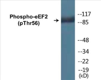 Western blot analysis of extracts from NIH-3T3 cells treated with Serum 10% 30', using eEF2 (Phospho-Thr56) Antibody.