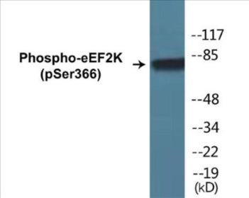 Western blot analysis of extracts from HeLa cells treated with serum 10% 15', using eEF2K (Phospho-Ser366) Antibody.