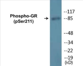 Western blot analysis of extracts from HeLa cells treated with Heat shock, using GR (Phospho-Ser211) Antibody.