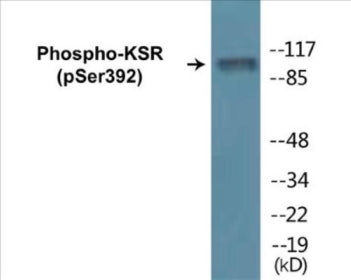 Western blot analysis of extracts from HepG2 cells, using KSR (Phospho-Ser392) Antibody.