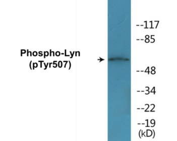 Western blot analysis of extracts from K562 cells treated with H2O2 100uM 30', using Lyn (Phospho-Tyr507) Antibody.