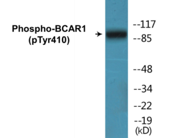 Western blot analysis of extracts from NIH-3T3 cells, using p130 Cas (Phospho-Tyr410) Antibody.