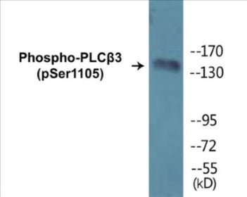 Western blot analysis of extracts from A431 cells, using PLCB3 (Phospho-Ser1105) Antibody.