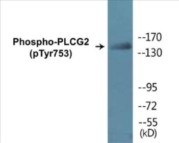 Western blot analysis of extracts from HepG2 cells treated with Na3VO4 0.3mM 40', using PLCG2 (Phospho-Tyr753) Antibody.