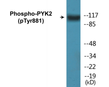 Western blot analysis of extracts from mouse brain, using PYK2 (Phospho-Tyr881) Antibody.