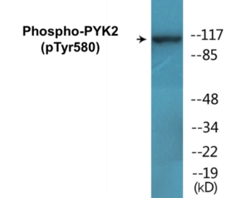Western blot analysis of extracts from K562 cells, using PYK2 (Phospho-Tyr580) Antibody.