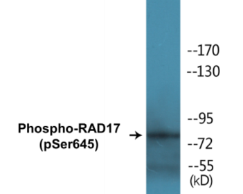 Western blot analysis of extracts from HeLa cells treated with UV 15', using RAD17 (Phospho-Ser645) Antibody.