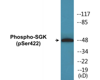 Western blot analysis of extracts from HeLa cells treated with Insulin 0.01U/ml 15', using SGK (Phospho-Ser422) Antibody.