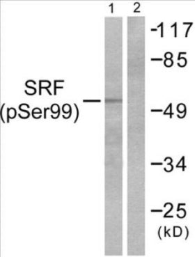 Western blot analysis of extracts from LOVO cells treated with Serum 10% 15', using SRF (Phospho-Ser99) Antibody.