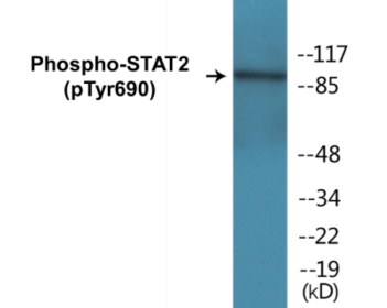 Western blot analysis of extracts from HeLa cells treated with IFN 2500U/ml 30', using STAT2 (Phospho-Tyr690) Antibody.