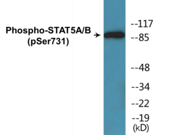 Western blot analysis of extracts from RAW264.7 cells treated with EGF 200ng/ml 30', using STAT5B (Phospho-Ser731) Antibody.