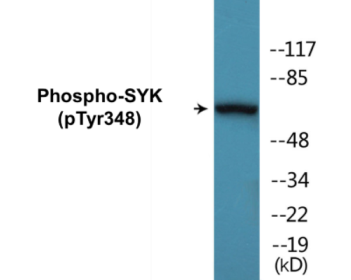 Western blot analysis of extracts from COS7 cells treated with EGF 200ng/ml 30', using SYK (Phospho-Tyr348) Antibody.