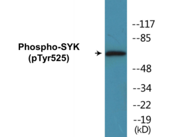 Western blot analysis of extracts from A549 cells, using SYK (Phospho-Tyr525) Antibody.