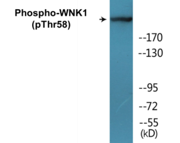 Western blot analysis of extracts from 293 cells treated with EGF 200ng/ml 30', using WNK1 (Phospho-Thr58) Antibody.