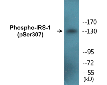 Western blot analysis of extracts from K562 cells, using IRS-1 (Phospho-Ser307) Antibody.