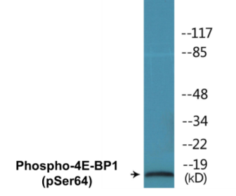 Western blot analysis of extracts from Jurkat cells treated with Insulin 0.01U/ml 15', using 4E-BP1 (Phospho-Ser64) Antibody.
