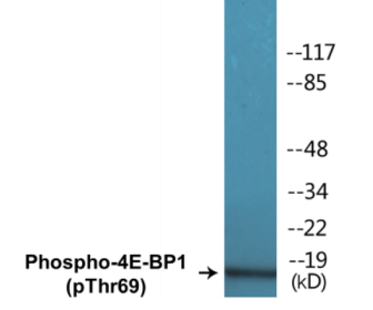 Western blot analysis of extracts from Jurkat cells treated with EGF 200ng/ml 30', using 4E-BP1 (Phospho-Thr69) Antibody.