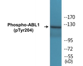 Western blot analysis of extracts from COS7 cells treated with Adriamycin 0.5ug/ml 24h, using Abl (Phospho-Tyr204) Antibody.