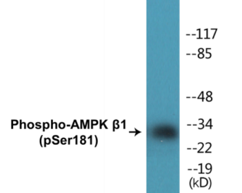 Western blot analysis of extracts from COLO205 cells and HuvEc cells, using AMPK beta1 (Phospho-Ser181) Antibody.