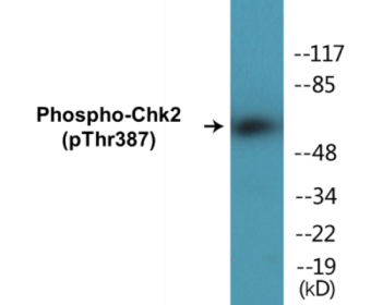 Western blot analysis of extracts from Jurkat cells, using Chk2 (Phospho-Thr387) Antibody.