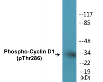 Western blot analysis of extracts from Jurkat cells treated with EGF 200ng/ml 30', using Cyclin D1 (Phospho-Thr286) Antibody.