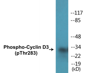 Western blot analysis of extracts from K562 cells treated with UV 5', using Cyclin D3 (Phospho-Thr283) Antibody.
