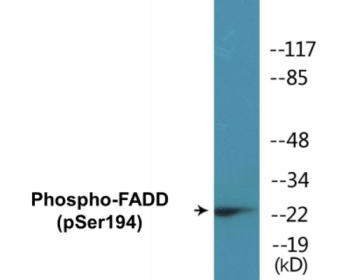 Western blot analysis of extracts from HeLa cells treated with Paclitaxel 1uM 60', using FADD (Phospho-Ser194) Antibody.