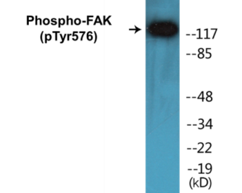 Western blot analysis of extracts from NIH-3T3 cells, using FAK (Phospho-Tyr576) Antibody.
