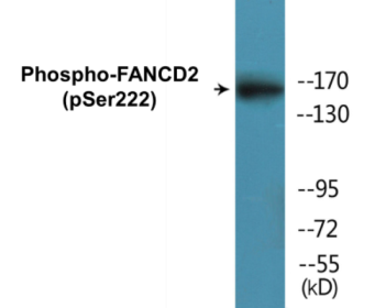 Western blot analysis of extracts from HT29 cells treated with Calyculin A 50ng/ml 30', using FANCD2 (Phospho-Ser222) Antibody.