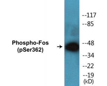 Western blot analysis of extracts from K562 cells treated with forskolin 40nM 30', using Fos (Phospho-Ser362) Antibody.