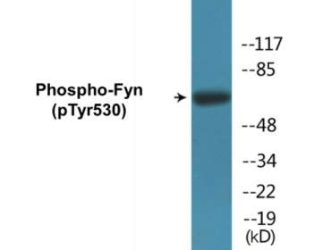 Western blot analysis of extracts from 293 cells treated with H2O2 100uM 15', using Fyn (Phospho-Tyr530) Antibody.