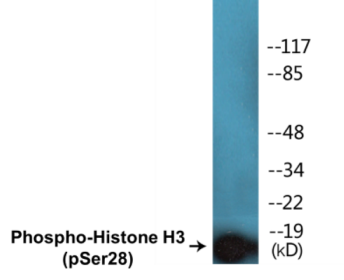 Western blot analysis of extracts from HuvEc cells treated with Serum 20% 30', using Histone H3 (Phospho-Ser28) Antibody.