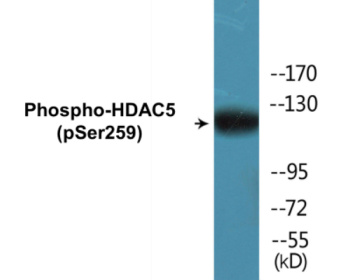 Western blot analysis of extracts from HepG2 cells, using HDAC5 (Phospho-Ser259) Antibody.