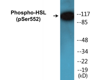 Western blot analysis of extracts from K562 cells, using HSL (Phospho-Ser552) Antibody.