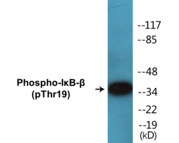 Western blot analysis of extracts from 293 cells treated with TNF-a 20ng/ml 30', using IkappaB-beta (Phospho-Thr19) Antibody.