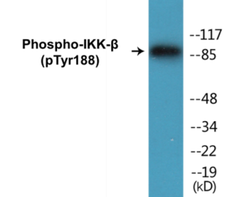 Western blot analysis of extracts from COS7 cells, using IKK-beta (Phospho-Tyr188) Antibody.