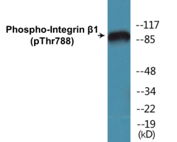 Western blot analysis of extracts from HeLa cells treated with UV 15', using Integrin beta1 (Phospho-Thr788) Antibody.