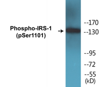 Western blot analysis of extracts from COS7 cells treated with Calyculin A 50ng/ml 30', using IRS-1 (Phospho-Ser1101) Antibody.