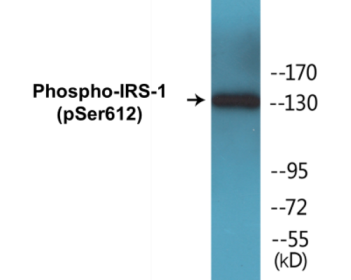 Western blot analysis of extracts from HuvEc cells treated with insulin 0.01U/ml 30', using IRS-1 (Phospho-Ser612) Antibody.