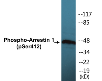Western blot analysis of extracts from COS7 cells treated with Etoposide 25uM 60', using Arrestin 1 (Phospho-Ser412) Antibody.