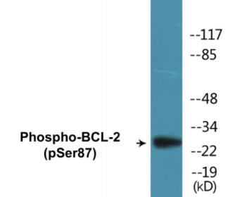 Western blot analysis of extracts from HeLa cells treated with nocodazole 1ug/ml 18h, using BCL-2 (Phospho-Ser87) Antibody.