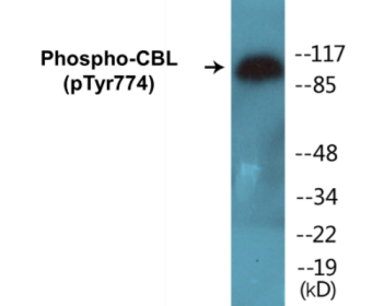Western blot analysis of extracts from HeLa cells treated with EGF 200ng/ml 30', using CBL (Phospho-Tyr774) Antibody.